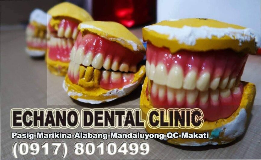 Echano Dental Clinic – Pasig